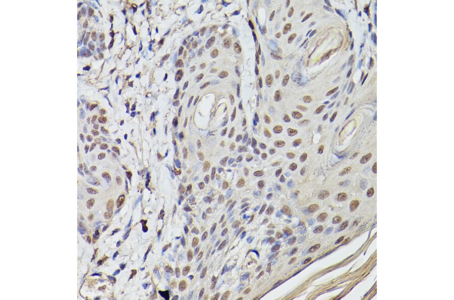 Immunohistochemistry - Anti-Pea3 Antibody (A14982) - Antibodies.com