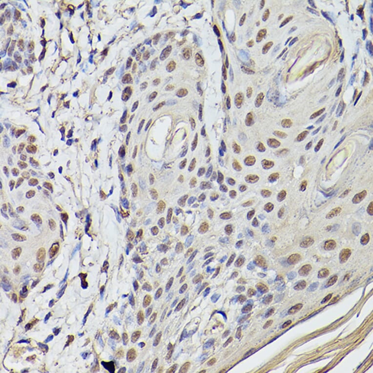 Immunohistochemistry - Anti-Pea3 Antibody (A14982) - Antibodies.com