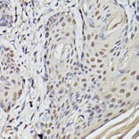 Immunohistochemistry - Anti-Pea3 Antibody (A14982) - Antibodies.com