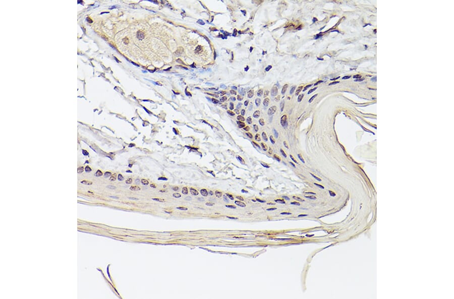 Immunohistochemistry - Anti-Pea3 Antibody (A14982) - Antibodies.com