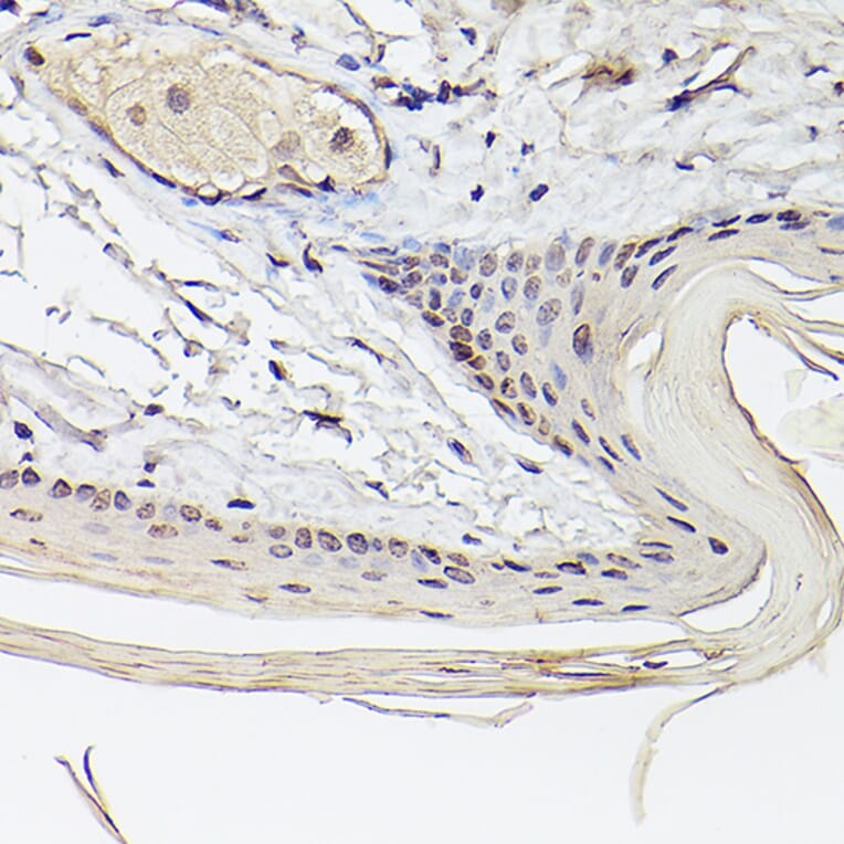 Immunohistochemistry - Anti-Pea3 Antibody (A14982) - Antibodies.com