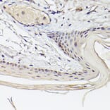 Immunohistochemistry - Anti-Pea3 Antibody (A14982) - Antibodies.com