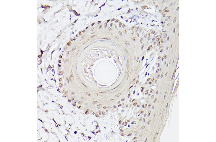 Immunohistochemistry - Anti-Pea3 Antibody (A14982) - Antibodies.com