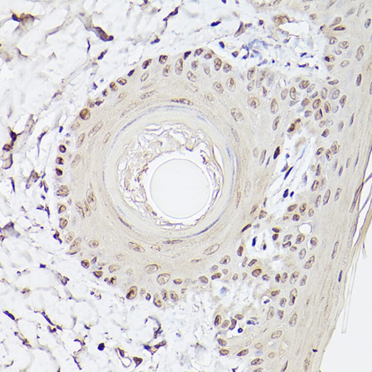 Immunohistochemistry - Anti-Pea3 Antibody (A14982) - Antibodies.com