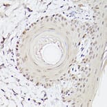 Immunohistochemistry - Anti-Pea3 Antibody (A14982) - Antibodies.com