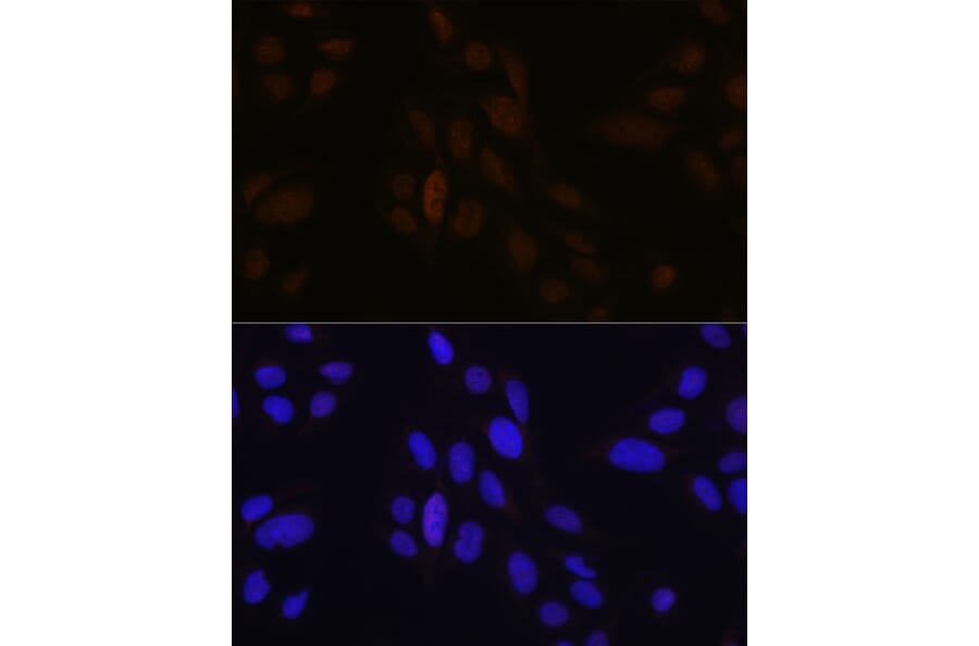 Immunofluorescence - Anti-Pea3 Antibody (A14982) - Antibodies.com