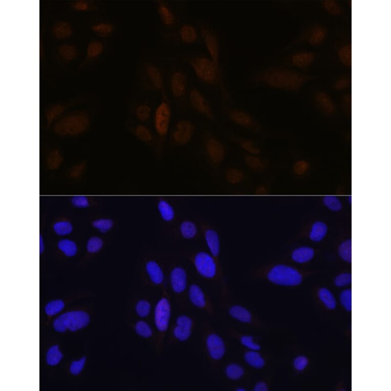 Immunofluorescence - Anti-Pea3 Antibody (A14982) - Antibodies.com