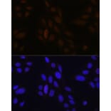 Immunofluorescence - Anti-Pea3 Antibody (A14982) - Antibodies.com