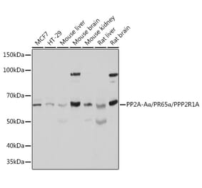 Western Blot - Anti-PPP2R1A Antibody (A14983) - Antibodies.com