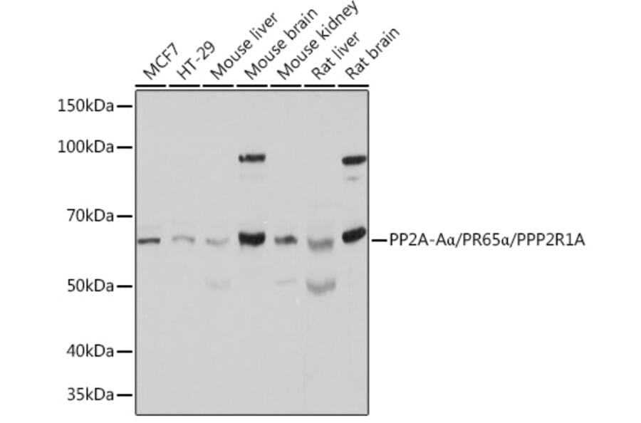 Western Blot - Anti-PPP2R1A Antibody (A14983) - Antibodies.com