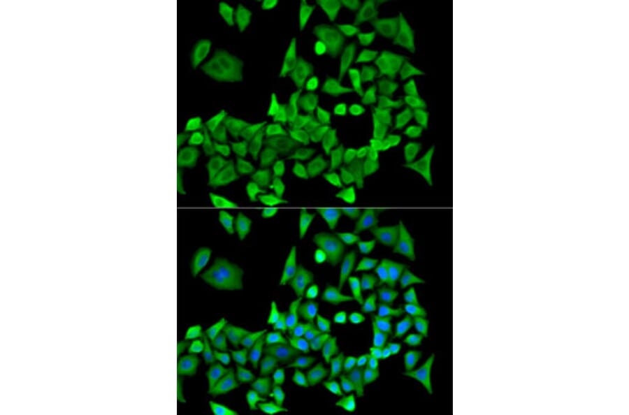 Immunofluorescence - Anti-PPP2R1A Antibody (A14983) - Antibodies.com