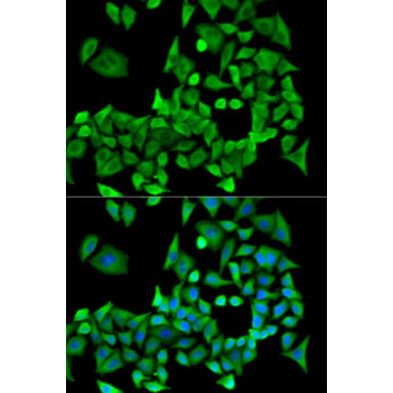 Immunofluorescence - Anti-PPP2R1A Antibody (A14983) - Antibodies.com