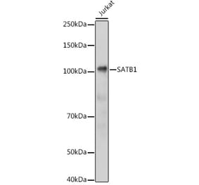 Western Blot - Anti-SATB1 Antibody (A14984) - Antibodies.com