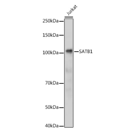 Western Blot - Anti-SATB1 Antibody (A14984) - Antibodies.com