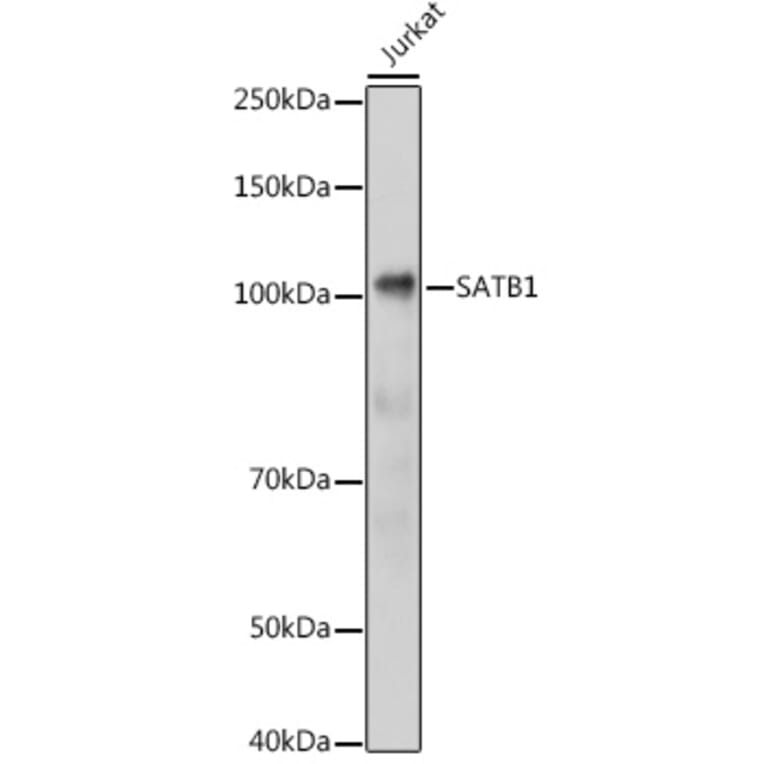 Western Blot - Anti-SATB1 Antibody (A14984) - Antibodies.com