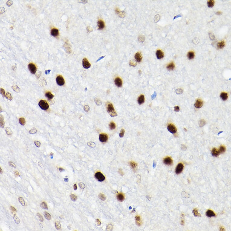 Immunohistochemistry - Anti-SATB1 Antibody (A14984) - Antibodies.com