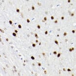 Immunohistochemistry - Anti-SATB1 Antibody (A14984) - Antibodies.com