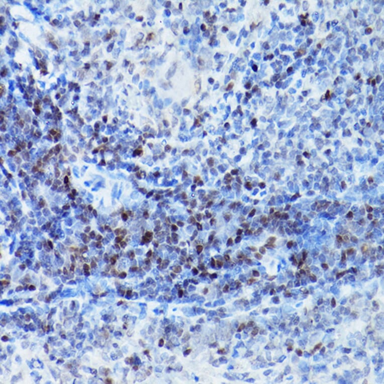 Immunohistochemistry - Anti-SATB1 Antibody (A14984) - Antibodies.com