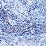 Immunohistochemistry - Anti-SATB1 Antibody (A14984) - Antibodies.com