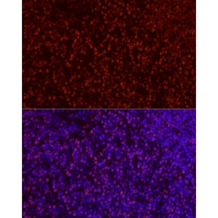 Immunofluorescence - Anti-SATB1 Antibody (A14984) - Antibodies.com