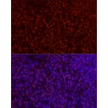Immunofluorescence - Anti-SATB1 Antibody (A14984) - Antibodies.com
