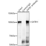 Western Blot - Anti-SATB1 Antibody (A14984) - Antibodies.com