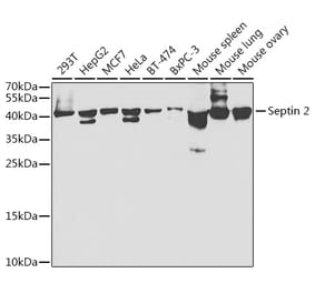 Western Blot - Anti-Septin 2 Antibody (A14985) - Antibodies.com