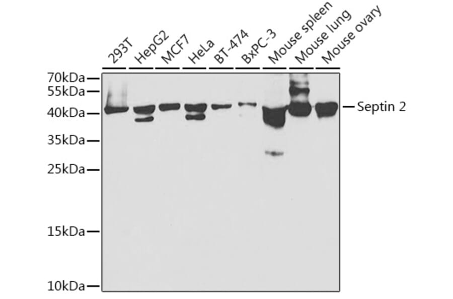 Western Blot - Anti-Septin 2 Antibody (A14985) - Antibodies.com