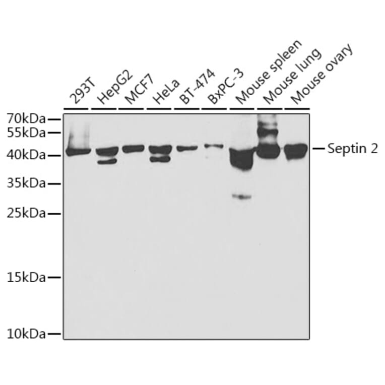 Western Blot - Anti-Septin 2 Antibody (A14985) - Antibodies.com
