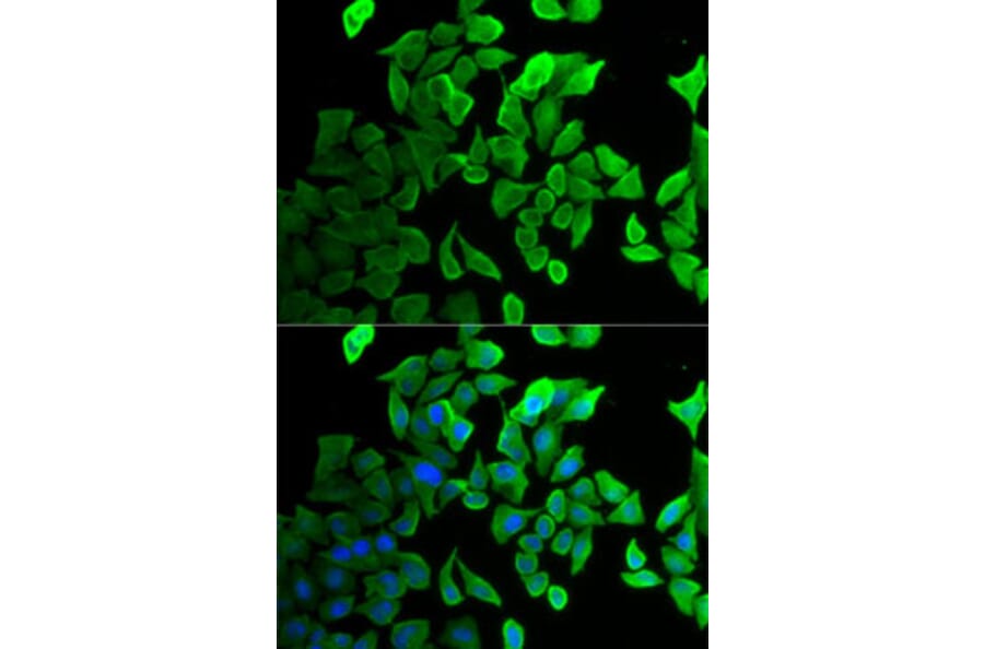 Immunofluorescence - Anti-Septin 2 Antibody (A14985) - Antibodies.com