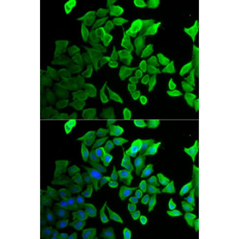 Immunofluorescence - Anti-Septin 2 Antibody (A14985) - Antibodies.com