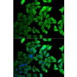 Immunofluorescence - Anti-Septin 2 Antibody (A14985) - Antibodies.com