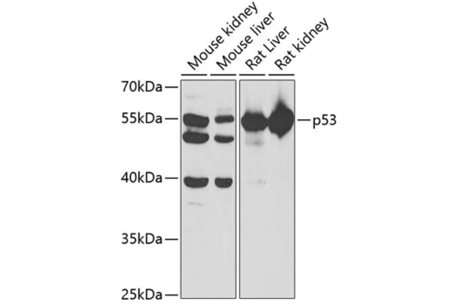 Western Blot - Anti-p53 Antibody (A14986) - Antibodies.com