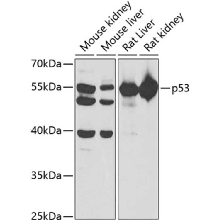 Western Blot - Anti-p53 Antibody (A14986) - Antibodies.com