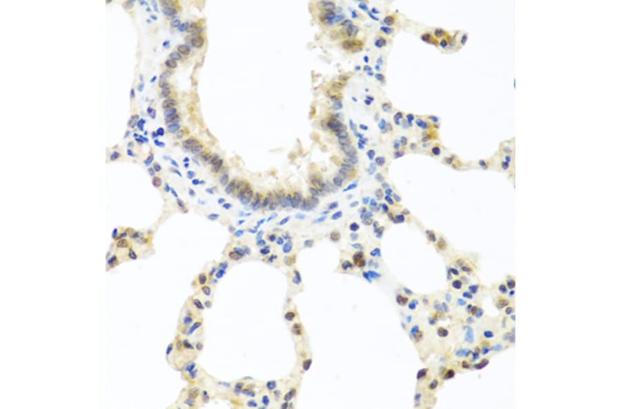 Immunohistochemistry - Anti-DEDD Antibody (A5806) - Antibodies.com