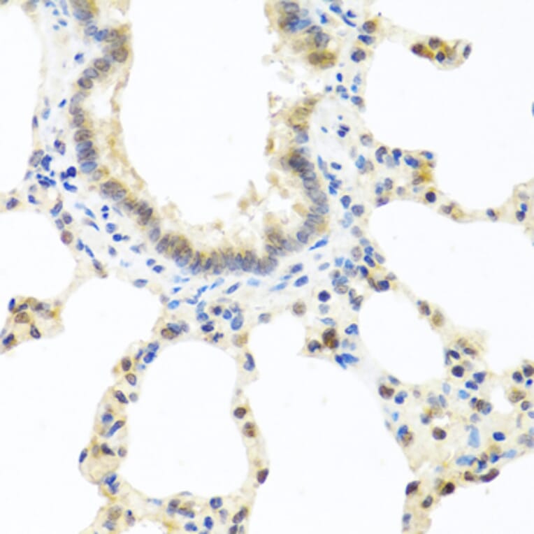 Immunohistochemistry - Anti-DEDD Antibody (A5806) - Antibodies.com