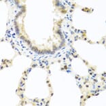 Immunohistochemistry - Anti-DEDD Antibody (A5806) - Antibodies.com