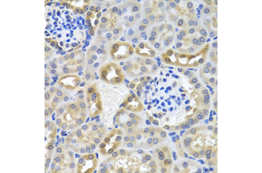 Immunohistochemistry - Anti-DEDD Antibody (A5806) - Antibodies.com