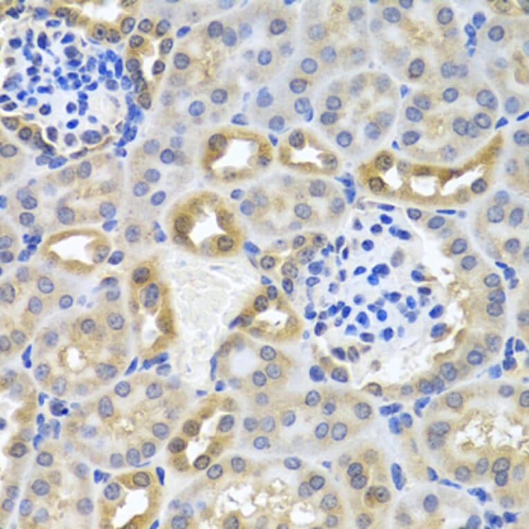 Immunohistochemistry - Anti-DEDD Antibody (A5806) - Antibodies.com