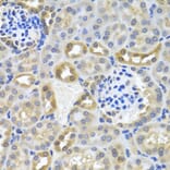 Immunohistochemistry - Anti-DEDD Antibody (A5806) - Antibodies.com