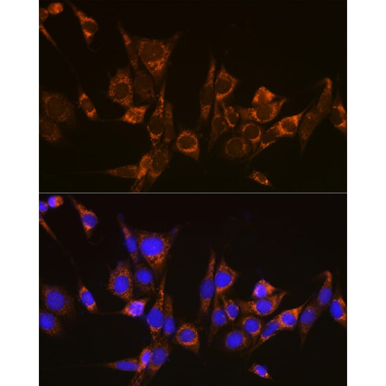 Immunofluorescence - Anti-ATG3 Antibody (A14989) - Antibodies.com