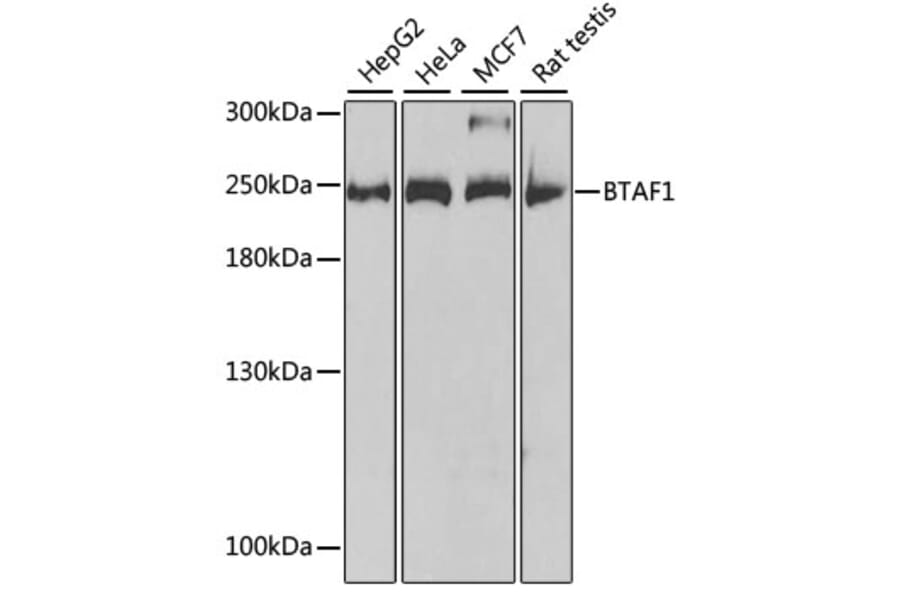 Western Blot - Anti-BTAF1 Antibody (A14990) - Antibodies.com