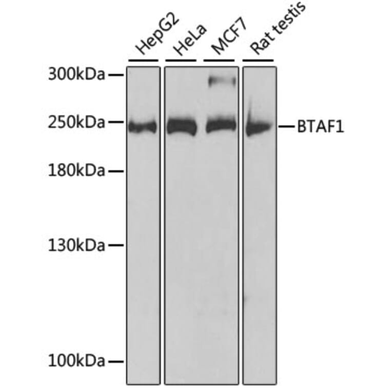 Western Blot - Anti-BTAF1 Antibody (A14990) - Antibodies.com