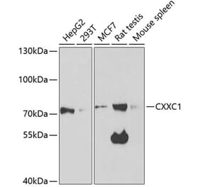 Western Blot - Anti-CGBP Antibody (A14991) - Antibodies.com