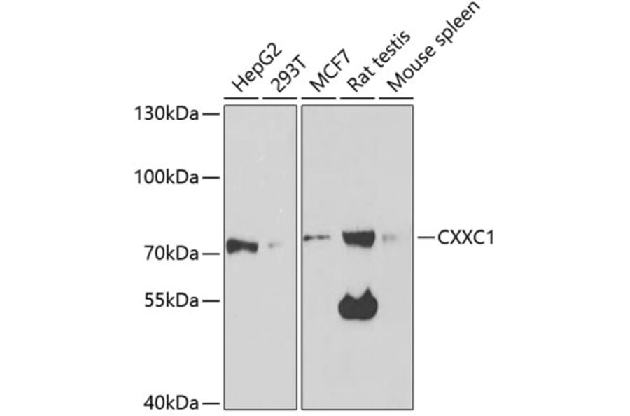 Western Blot - Anti-CGBP Antibody (A14991) - Antibodies.com