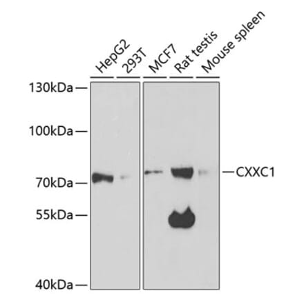 Western Blot - Anti-CGBP Antibody (A14991) - Antibodies.com