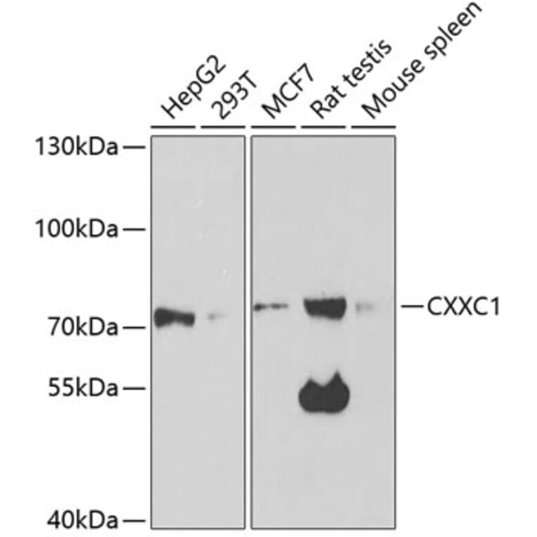 Western Blot - Anti-CGBP Antibody (A14991) - Antibodies.com
