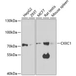 Western Blot - Anti-CGBP Antibody (A14991) - Antibodies.com