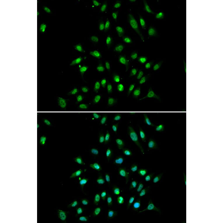 Immunofluorescence - Anti-CGBP Antibody (A14991) - Antibodies.com