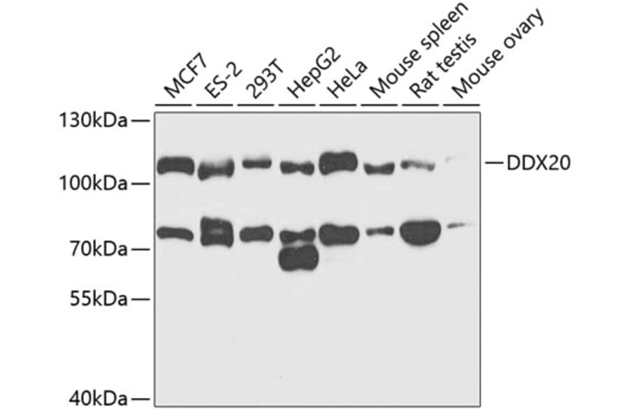 Western Blot - Anti-Gemin 3 Antibody (A14992) - Antibodies.com